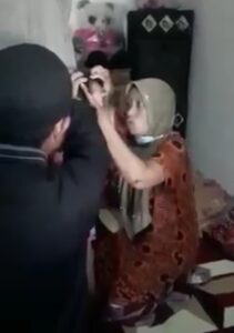 Bocah Malang Yang Dicongkel Matanya Demi Pesugihan Hari Ini Akan Dioperasi